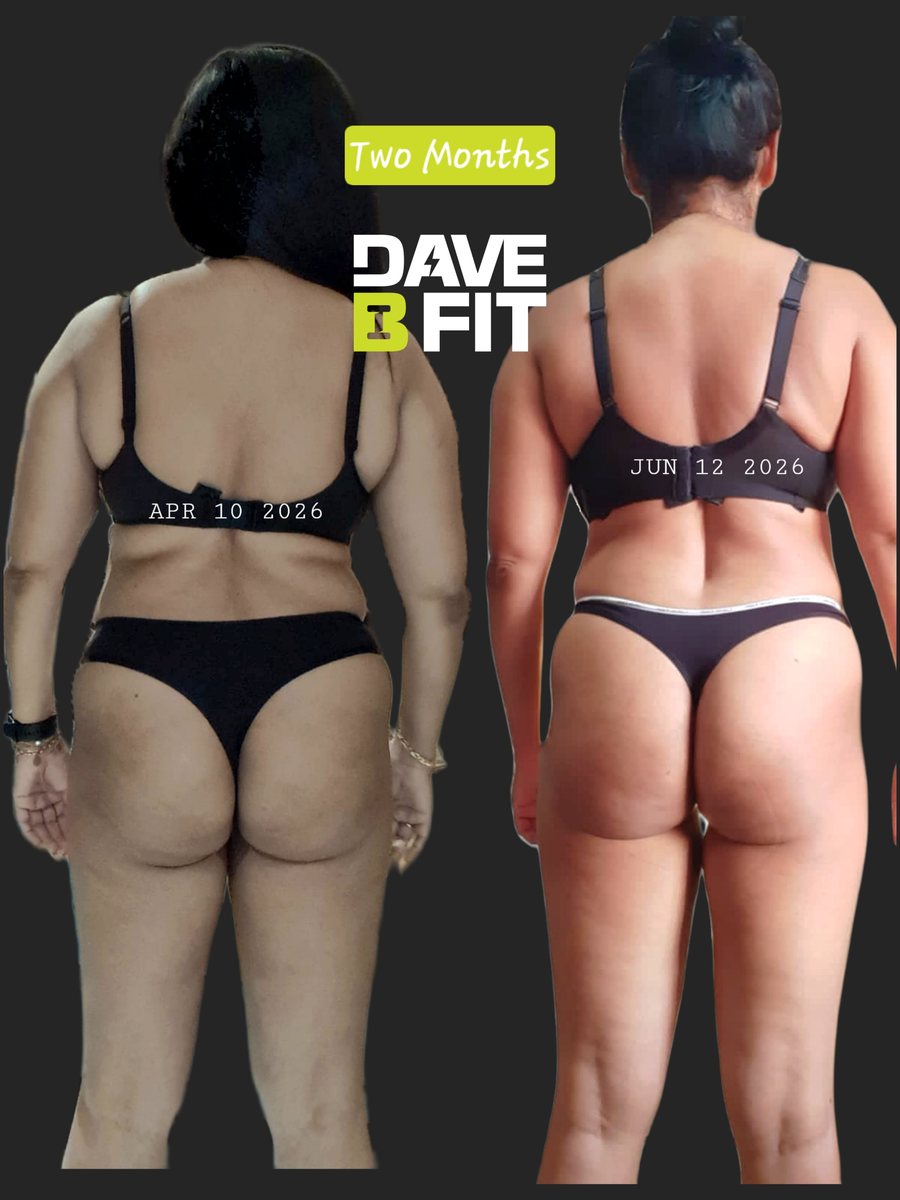 Client before and after over two months, shown from behind.